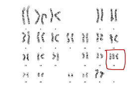 Karyotype - Intro To Genetics